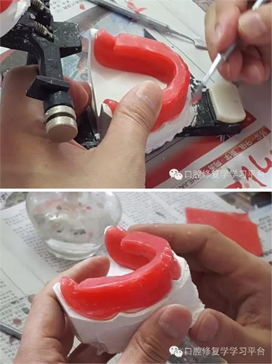 全口义齿的制作:排牙方法 科贸嘉友收录