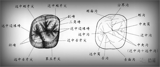 一般有四个牙尖,即近中颊尖,远中颊尖,近中舌尖和远中舌尖.