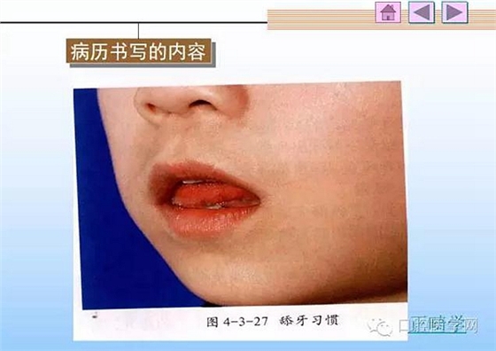 口腔正畸学病历书写  