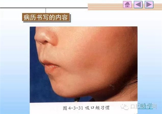 口腔正畸学病历书写  