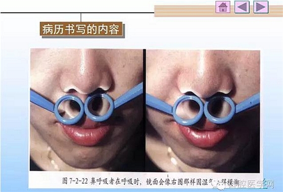 口腔正畸学病历书写  