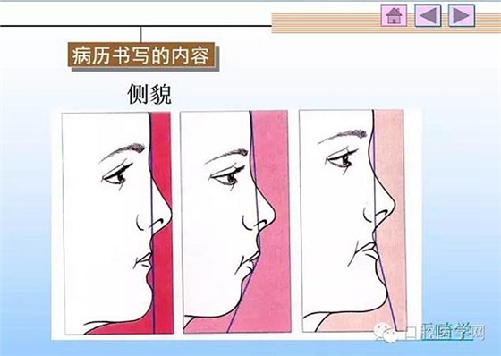 口腔正畸学病历书写  