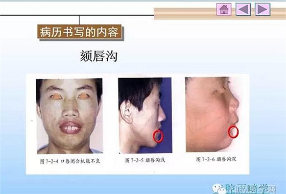 口腔正畸学病历书写  