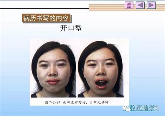 口腔正畸学病历书写  