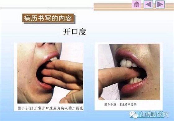 口腔正畸学病历书写  
