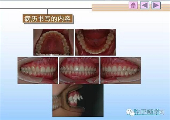 口腔正畸学病历书写  