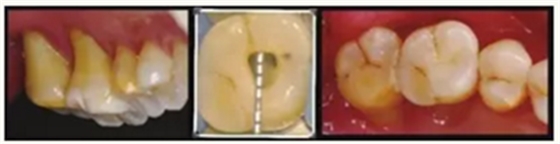 显微知著 从齿开始——上海第九人民医院牙体牙髓科 显微知著 从齿开始——上海第九人民医院牙体牙髓科