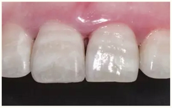 显微知著 从齿开始——上海第九人民医院牙体牙髓科 显微知著 从齿开始——上海第九人民医院牙体牙髓科