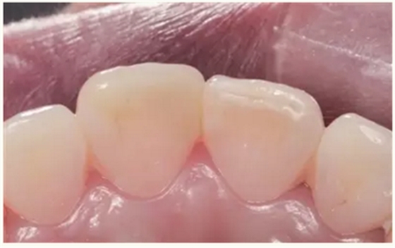 显微知著 从齿开始——上海第九人民医院牙体牙髓科 显微知著 从齿开始——上海第九人民医院牙体牙髓科