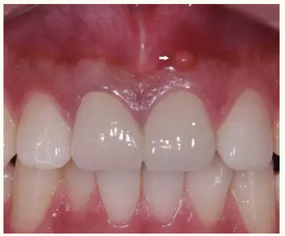 显微知著 从齿开始——上海第九人民医院牙体牙髓科 显微知著 从齿开始——上海第九人民医院牙体牙髓科