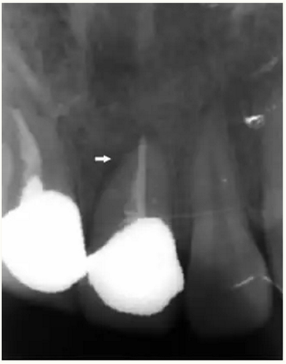 显微知著 从齿开始——上海第九人民医院牙体牙髓科 显微知著 从齿开始——上海第九人民医院牙体牙髓科