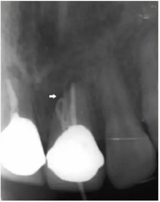 显微知著 从齿开始——上海第九人民医院牙体牙髓科 显微知著 从齿开始——上海第九人民医院牙体牙髓科