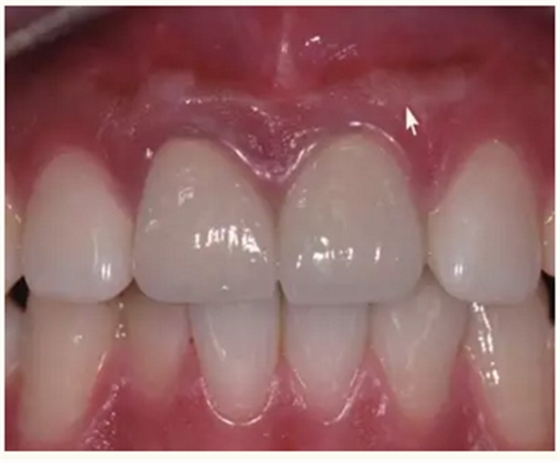 显微知著 从齿开始——上海第九人民医院牙体牙髓科 显微知著 从齿开始——上海第九人民医院牙体牙髓科