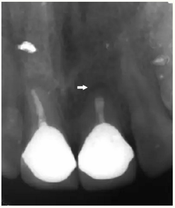 显微知著 从齿开始——上海第九人民医院牙体牙髓科 显微知著 从齿开始——上海第九人民医院牙体牙髓科
