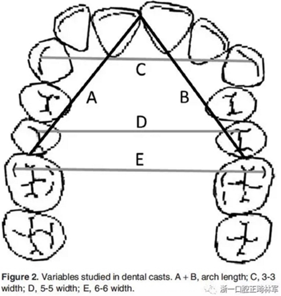正畸文献阅读--I、II类错牙合拔牙或不拔牙对上颌前牙段稳定性的影响