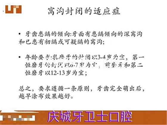 爱牙科普-来自临床的窝沟封闭
