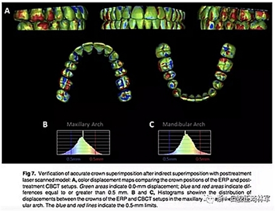 正畸文献阅读--正畸过程中牙根移动的三维监测