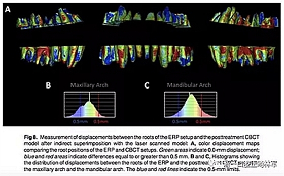 正畸文献阅读--正畸过程中牙根移动的三维监测
