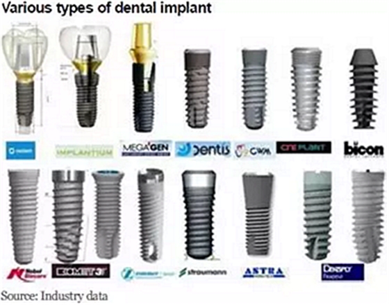 种植体，在全球牙科设备市场的变化！