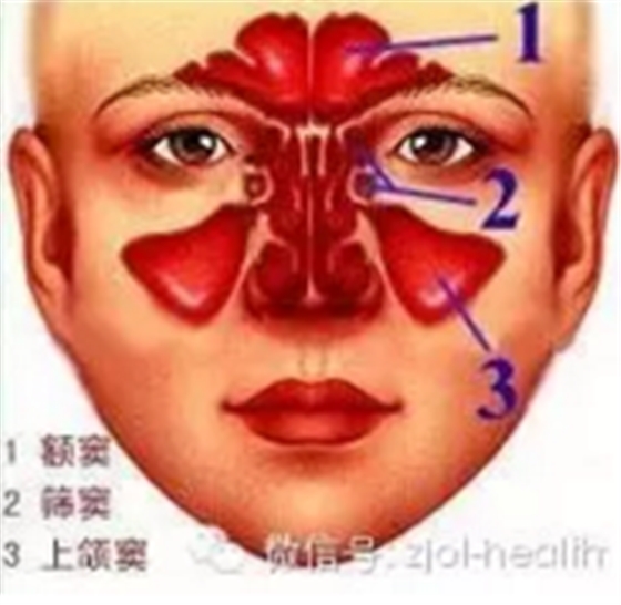 拔牙后引出&ldquo;偏头痛&rdquo;！这种情况绝不能置之不理！