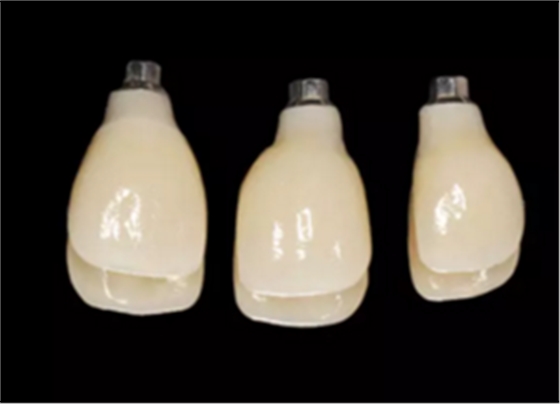 【病例分享】上颌多颗相邻前牙的“精确化”即刻种植修复一例 【病例分享】上颌多颗相邻前牙的“精确化”即刻种植修复一例