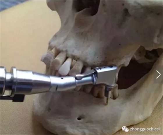 特殊植入部位及注意事项