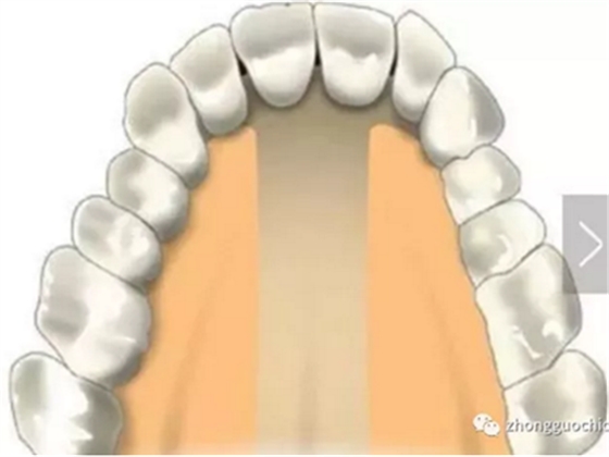 特殊植入部位及注意事项