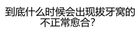 拔牙窝的处理-新思路 拔牙窝的处理-新思路