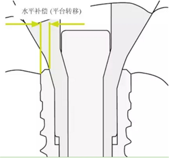 揭秘士卓曼种植体-基台的长期稳定性