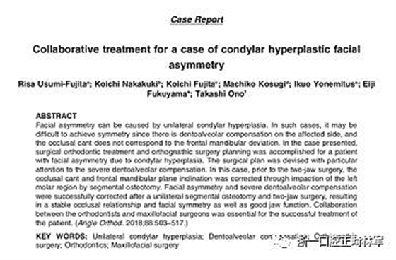 文献优秀正畸病例赏析-髁突增生性面部不对称的协同治疗1例