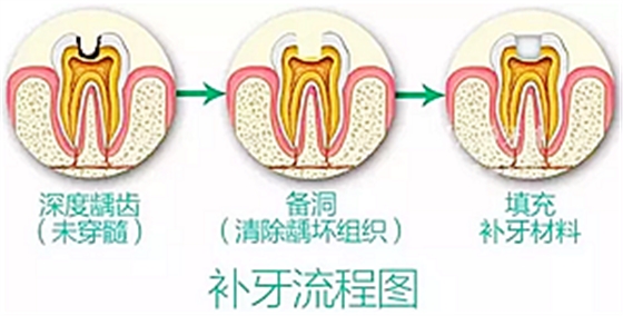 你总嚷着看牙“贵”还不是你自己造成的