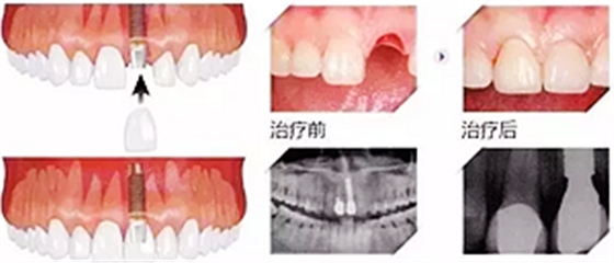 你总嚷着看牙“贵”还不是你自己造成的