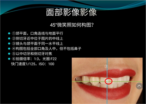 口内照摄影方法与技巧分享