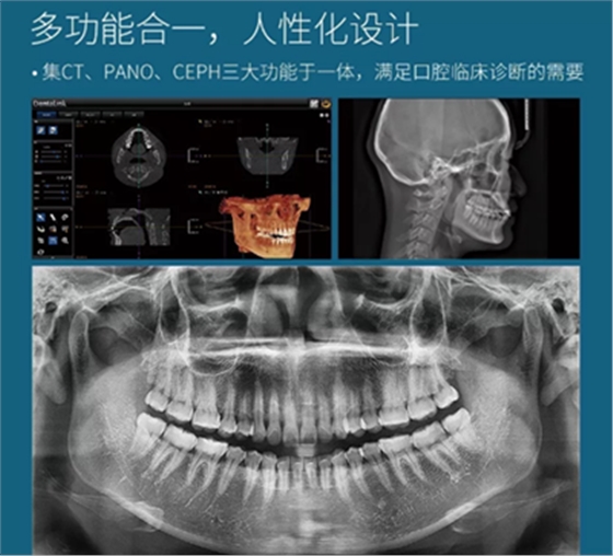 费森影像