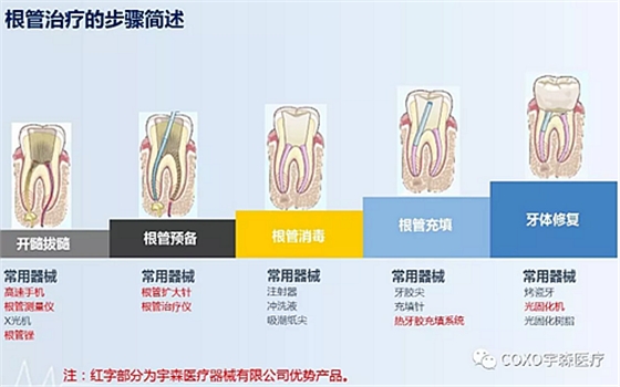 厂家来解说：多频技术的根管长度测定仪