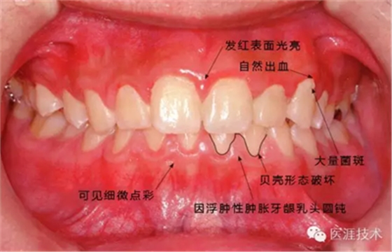 上海品瑞迈格磁致伸缩治疗仪