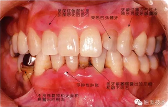 上海品瑞迈格磁致伸缩治疗仪