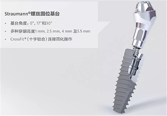 【热点回顾】带您深度了解无牙颌种植修复——Pro Arch