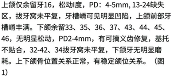 病例报道│全程数字化辅助无牙颌种植即刻负重