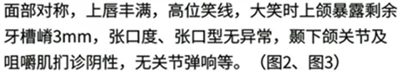 病例报道│全程数字化辅助无牙颌种植即刻负重