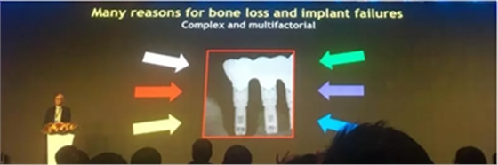 【听课笔记】种植体周围骨吸收因素研究与临床意义
