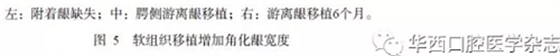 【专家共识】种植修复临床评价标准