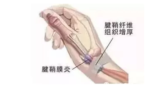 牙医必看！你的双手很重要！