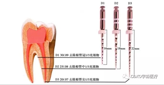 	（十一期）根管充填物的清理-牙胶的去除