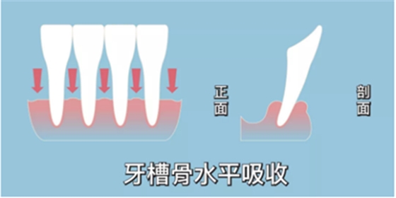 正畸矫正