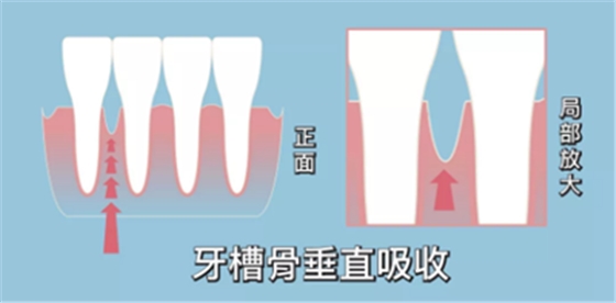 正畸矫正