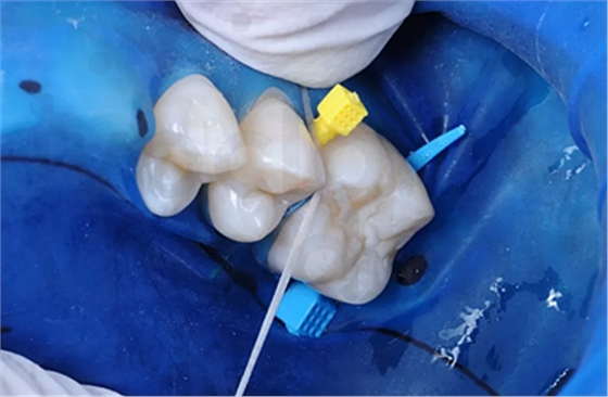 树脂知识 树脂知识