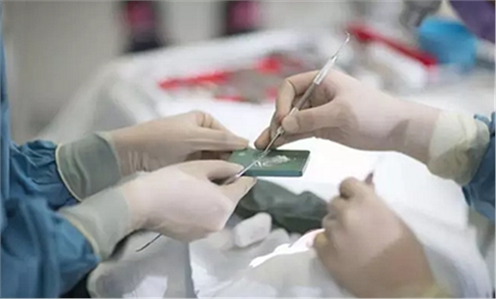 树脂知识 树脂知识