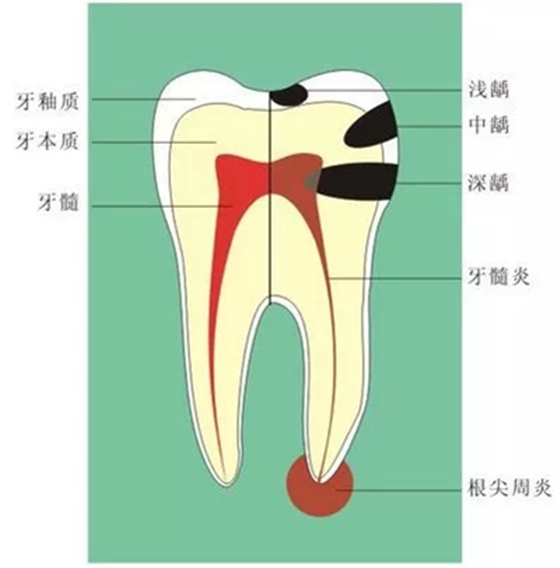 牙龈萎缩怎么办？
