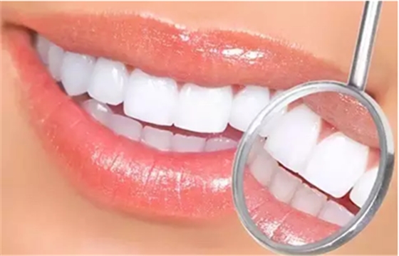 贴面备牙知多少? 贴面备牙知多少?